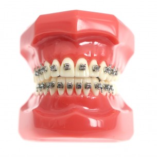 Tipondonto Modelo Tipodonto...