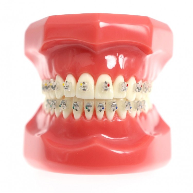 Tipondonto Modelo Tipodonto con Brackets Interactivos Cerámicos